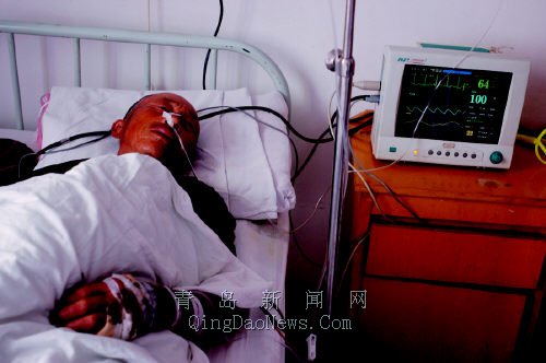 老人被蛇咬救治多日去世，胃肺出血背后的悲情故事